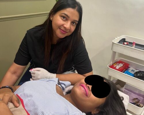 Lip Color Correction in Bangalore