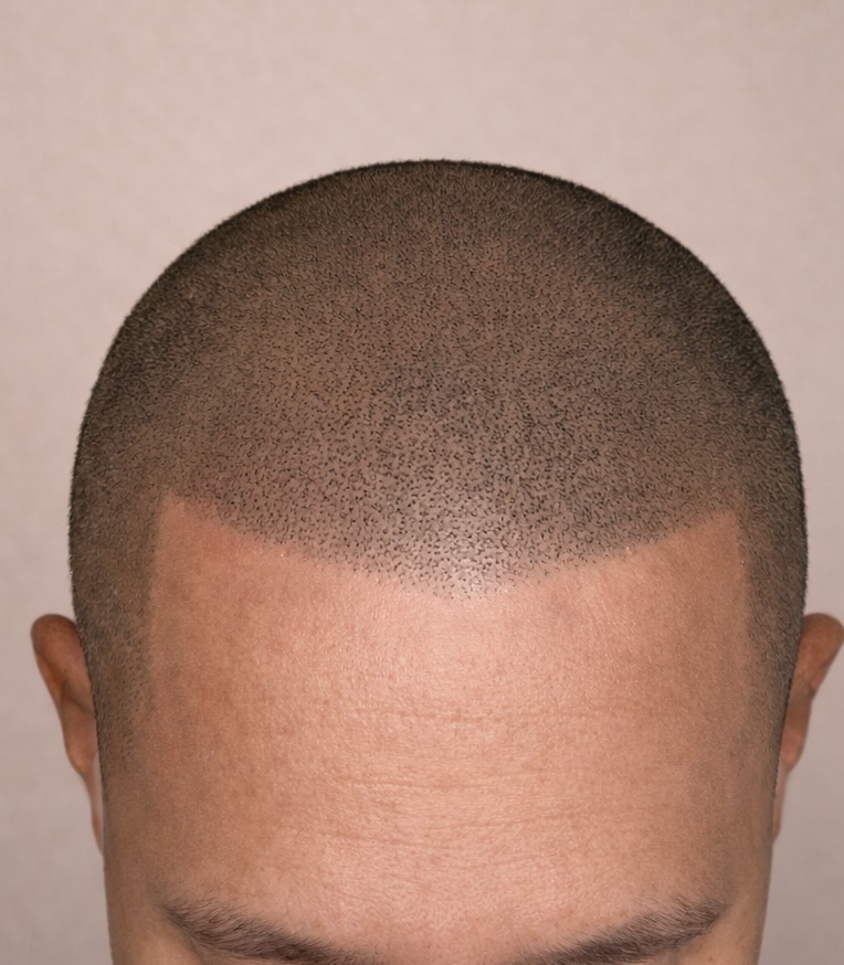 After